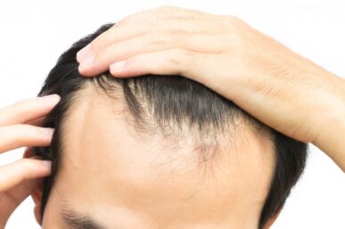 HEALTHY HABITS, BETTER HAIR: HOW LIFESTYLE CHOICES IMPACT HAIR RESTORATION