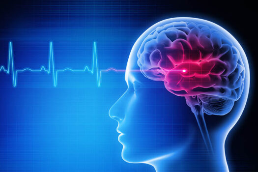 SMALL CHOICES, BIG IMPACT: KEEPING STOKE PREVENTION ON THE TABLE