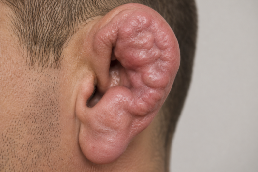 A PERMANENT INJURY IS THE INTERNET’S NEWEST SYMBOL OF MANHOOD